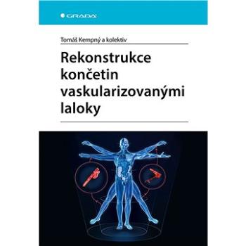 Rekonstrukce končetin vaskularizovanými laloky (978-80-271-3101-3)