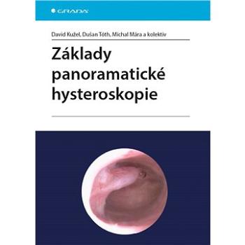 Základy panoramatické hysteroskopie (978-80-271-0303-4)