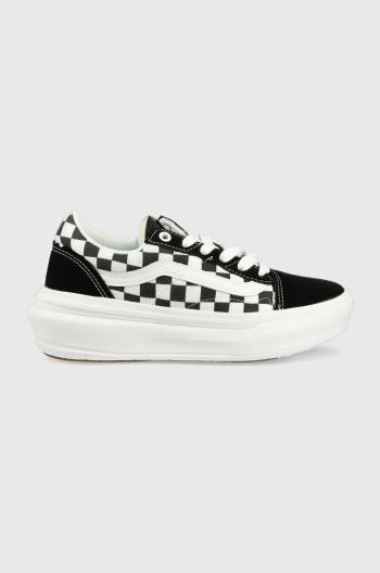 Tenisky Vans Old Skool Overt CC čierna farba, VN0A7Q5E95Y1