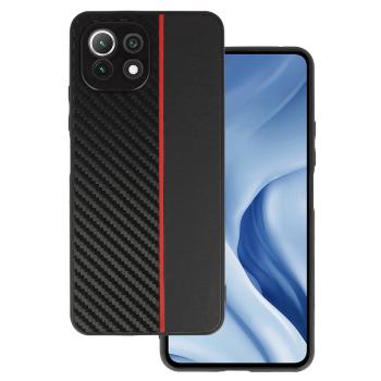 Tel Protect Xiaomi Mi 11 Lite 5G Puzdro Carbon  KP23503 čierna