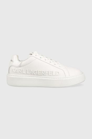 Kožené tenisky Karl Lagerfeld KL62210 MAXI KUP biela farba