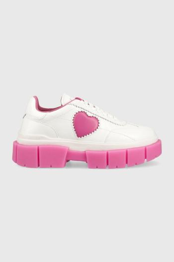 Kožené tenisky Love Moschino Sneakerd Belove 65 biela farba, JA15676G1G