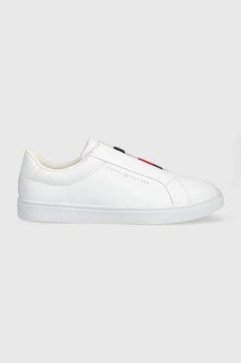 Kožené tenisky Tommy Hilfiger ELASTIC SLIP ON SNEAKER dámske, biela farba, FW0FW07032