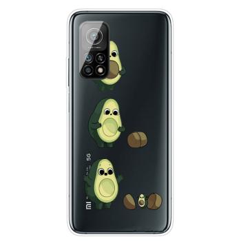 ART Silikónový kryt Xiaomi Mi 10T / Mi 10T Pro AVOCADO