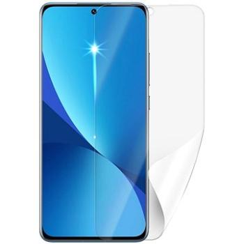 Screenshield XIAOMI 12 5G na displej (XIA-125G-D)