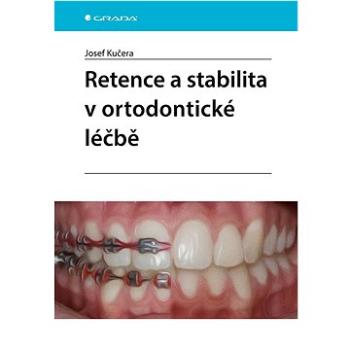 Retence a stabilita v ortodontické léčbě (978-80-271-3874-6)