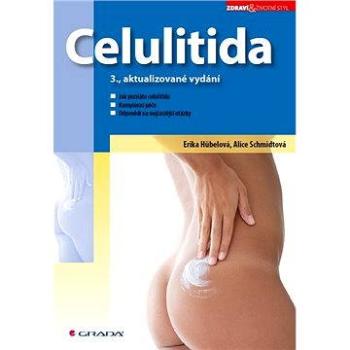 Celulitida (978-80-247-3932-8)