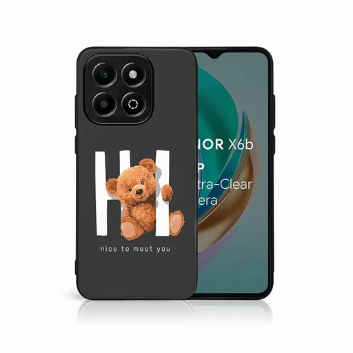 MY ART Ochranný kryt pre Honor X6b HI (182)