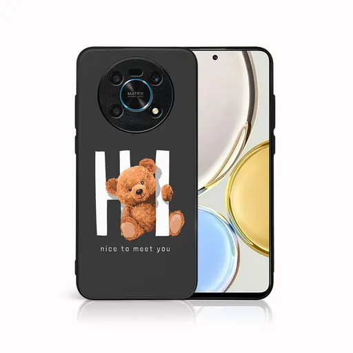 MY ART Ochranný kryt pre Honor Magic4 Lite 5G HI (182)