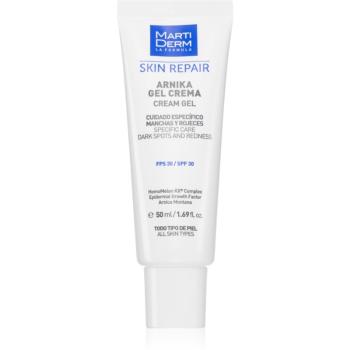 MartiDerm Skin Repair gélový krém proti tmavým škvrnám SPF 30 50 ml