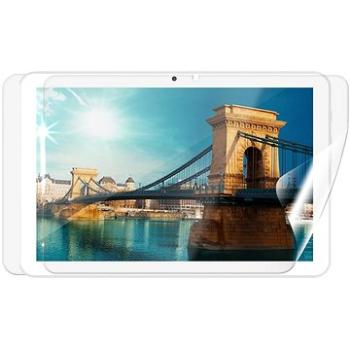 Screenshield IGET Smart W201 fólia na celé telo (IGT-SMW201-B)