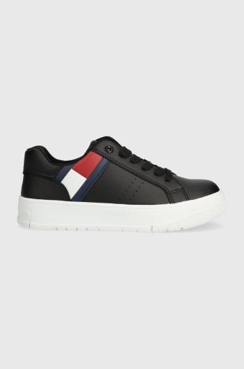 Detské tenisky Tommy Hilfiger čierna farba