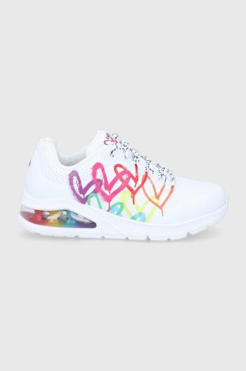 Topánky Skechers SKECHERS X JGOLDCROWN