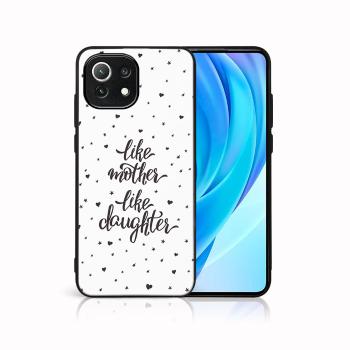 MY ART Ochranný kryt Xiaomi Mi 11 Lite / 11 Lite 5G / 11 Lite NE 5G-LIKE MOTHER (113)