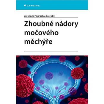 Zhoubné nádory močového měchýře (978-80-271-2503-6)