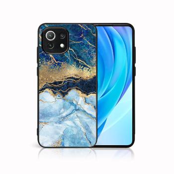 MY ART Ochranný kryt Xiaomi Mi 11 Lite / 11 Lite 5G / 11 Lite NE 5G -BLUE MARBLE (141)