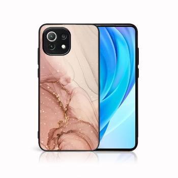 MY ART Ochranný kryt Xiaomi Mi 11 Lite / 11 Lite 5G / 11 Lite NE 5G -SHIMMER (152)