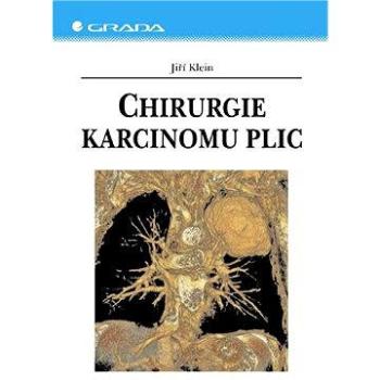 Chirurgie karcinomu plic (80-247-1384-5)