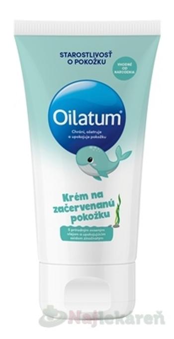 Oilatum krém ošetruje a chráni začervenanú pokožku 100ml