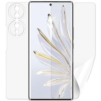 Screenshield HONOR 70 fólia na celé telo (HUA-HON70-B)