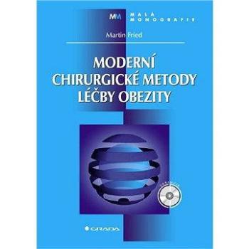 Moderní chirurgické metody léčby obezity (80-247-0958-9)