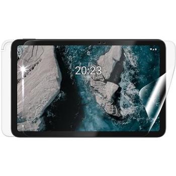 Screenshield NOKIA T20 na celé telo (NOK-T20-B)