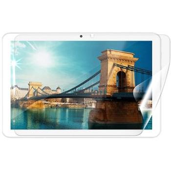 Screenshield IGET Smart W201 fólia na displej (IGT-SMW201-D)