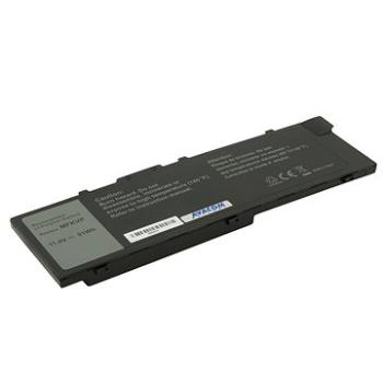 AVACOM pre Dell Precision 15 7000, 17 7000 Li-Pol 11,4 V 7982 mAh 91 Wh (NODE-P1570-80P)