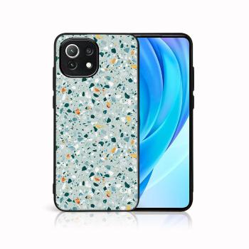 MY ART Ochranný kryt Xiaomi Mi 11 Lite / 11 Lite 5G / 11 Lite NE 5G -BLUE TERRAZZO (164)