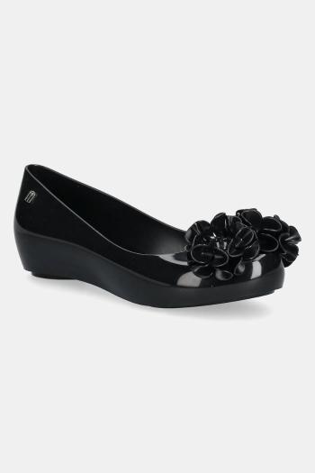 Baleríny Melissa ULTRAGIRL SPRINGTIME čierna farba, M 35706