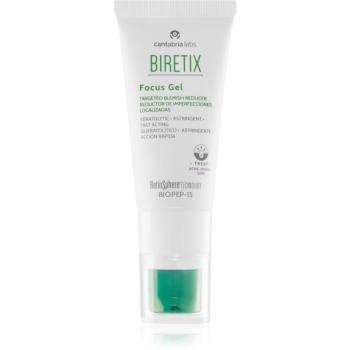 Biretix Treat Focus Gel hydratačný a upokojujúci gél pre mastnú pleť so sklonom k akné 15 ml