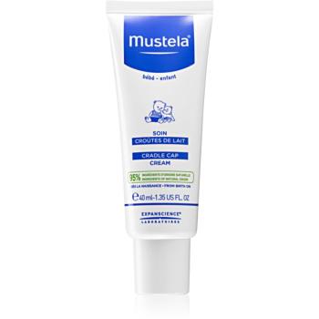 Mustela Bébé krém pre deti na šupiny vo vlasoch 40 ml