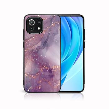 MY ART Ochranný kryt Xiaomi Mi 11 Lite / 11 Lite 5G / 11 Lite NE 5G -PURPLE (148)