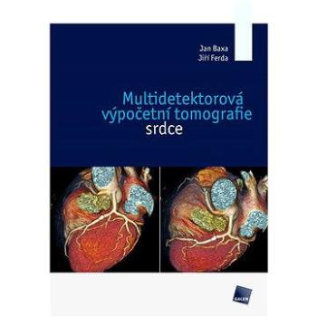 Multidetektorová výpočetní tomografie srdce (978-80-726-2880-3)