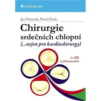 Chirurgie srdečních chlopní (978-80-247-2712-7)