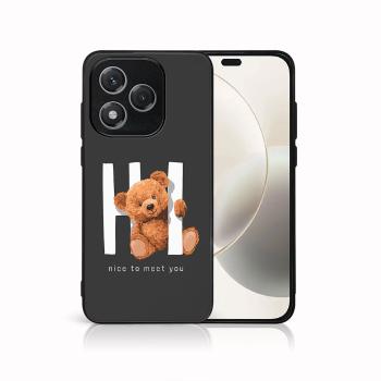 MY ART Ochranný kryt pre Honor 400 Lite 5G HI (182)