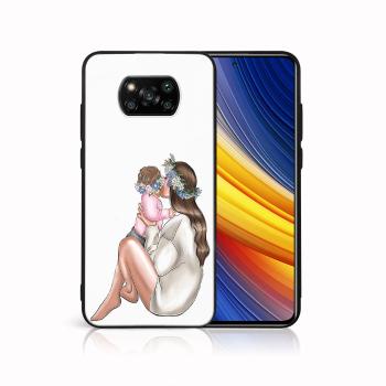 MY ART Ochranný kryt Xiaomi Poco X3 NFC / X3 Pro-BABY GIRL (111)