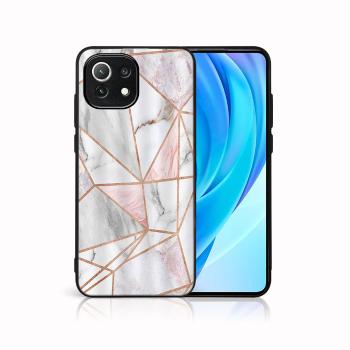 MY ART Ochranný kryt Xiaomi Mi 11 Lite / 11 Lite 5G / 11 Lite NE 5G -PINK MARBLE (143)