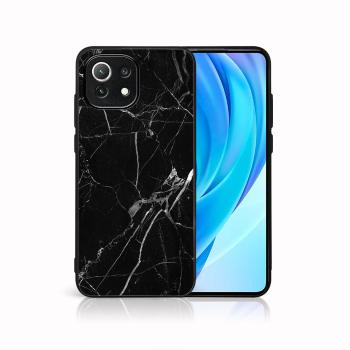 MY ART Ochranný kryt Xiaomi Mi 11 Lite / 11 Lite 5G / 11 Lite NE 5G -BLACK MARBLE (142)