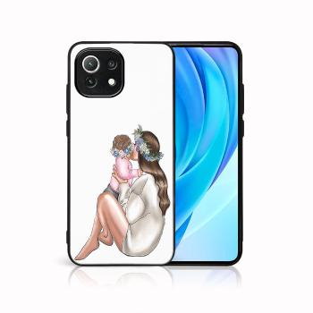 MY ART Ochranný kryt Xiaomi Mi 11 Lite / 11 Lite 5G / 11 Lite NE 5G-BABY GIRL (111)