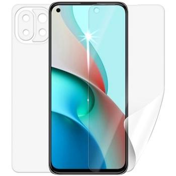 Screenshield pre XIAOMI Mi 11 Lite 5G na celé telo (XIA-MI11LT5G-B)