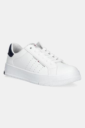 Detské tenisky Tommy Hilfiger biela farba, T3X9-33856