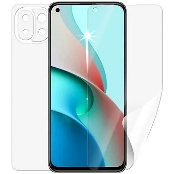 Screenshield pre XIAOMI Mi 11 Lite 5G na celé telo (XIA-MI11LT5G-B)