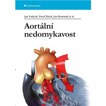 Aortální nedomykavost (978-80-247-5685-1)