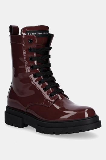 Detské topánky Tommy Hilfiger červená farba, T4A5-34025