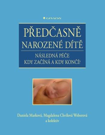 Předčasně narozené dítě - Následná péče kdy začíná a kdy končí? - Daniela Marková, Magdalena Chvílová Weberová